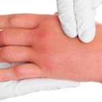 Evo zašto se sve više ljudi budi sa užasno natečenim rukama i stopalima