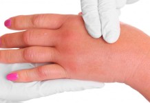 Evo zašto se sve više ljudi budi sa užasno natečenim rukama i stopalima