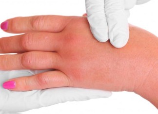 Evo zašto se sve više ljudi budi sa užasno natečenim rukama i stopalima