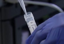 Novih 10 infekcija koronavirusom u Prijepolju Foto: Printscreen