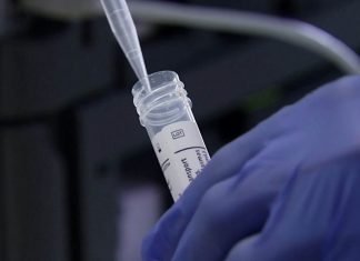 Samo jedan novozaraženi u Prijepolju Foto: Printscreen