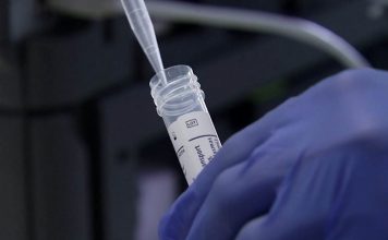 2.447 zaraženih i 61 preminulo od koronavirusa u Srbiji Foto: Printscreen