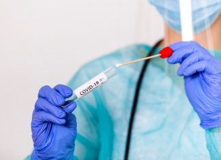 Od 1. januara skuplji PCR test u Srbiji