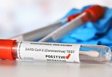 I dalje najviše novozaraženih u Prijepolju