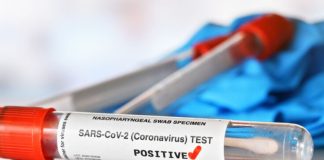 I dalje najviše novozaraženih u Prijepolju