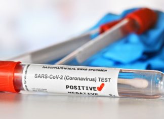 I dalje najviše novozaraženih u Prijepolju